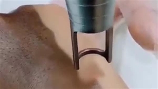 سفید کردن واژن