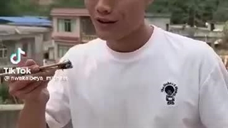 تا حالا زنبور خوردن کسی رو دیدید؟