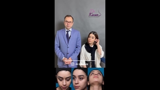 رضایت زیباجو از عمل زیبایی بینی