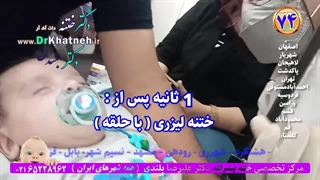 ختنه آقا کوچولوی تهرانی در آغوش پدر و مادر بدون درد استاد دکتر بلندی ترمیم زیبایی دندان
