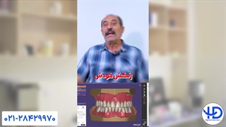 یه های‌دنت یه ایران