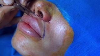 سانترال لب چیست؟