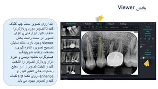 نحوه کار با نرم افزار سنسور rvg وودپیکر و فسفرپلیت woodpecker (بخش سوم)