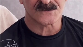 نظرات پس از گذاشتن دندان مصنوعی