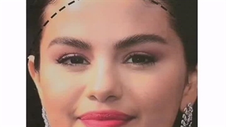 هر قسمت از تزریق ژل بوتاکس مناسب چه فرم صوتی است ؟