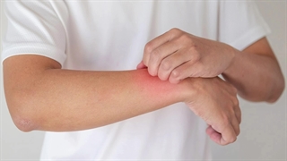 ۱۱۰۰ نکته پوست ،مو وزیبایی اگزما ۲  دکترعلی فلاحیان