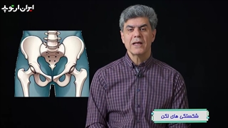 در مورد شکستگی های لگن چه میدانید