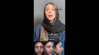 رضایت زیباجو از عمل زیبایی بینی