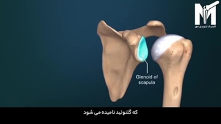 فیلم جراحی تعویض مفصل شانه