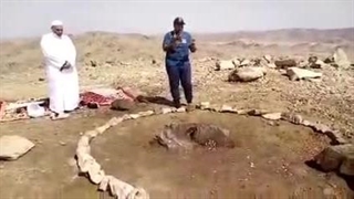 مرقد مطهّر و غریب حضرت آمنه بنت وهب سلام الله علیها، مادر والامقام رسول‌خدا ص تزریق بوتاکس