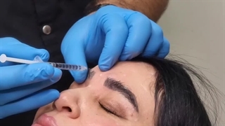 تزریق بوتاکس کل صورت