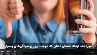 تاثیر مشروبات بر دندان