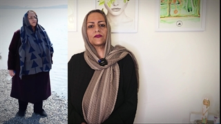 تجربه عمل بای پس امگا(مینی) و ۵۱ کیلو گاهش وزن