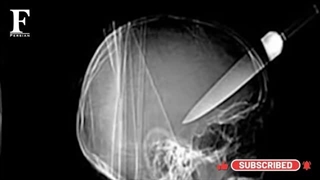 خفن ترین عکس های رادیولوژی جهان !