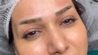 مقایسه پایان کار یک میکروبلیدنگ مبتدی و میکروبلیدینگ حرفه ای