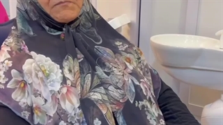 رضایت مراجعه کننده از نصب دندان مصنوعی