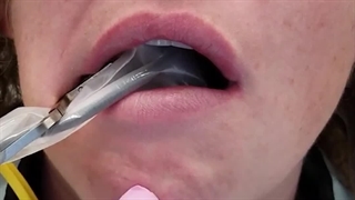 سنسور RVG وودپیکر مدل i sensor