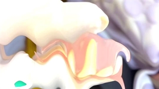 نصب دندان مصنوعی تکه ایی