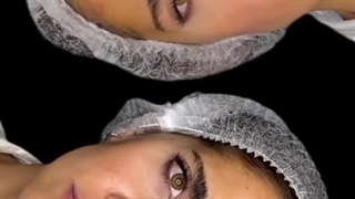 خداحافظی با چین و چروک ها با معجزه بوتاکس