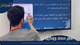 اموزش بلفاروپلاستی بالشتک های اطراف چشم