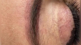 ریموو تاتو مریم اسماعیلی بوشهر