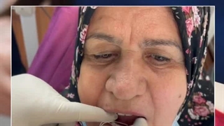 درمان تحلیل لثه