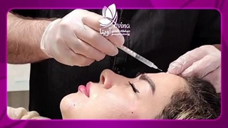 کلینیک تخصصی پوست، مو آوینا لیزر موهای زائد