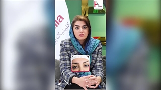 تجربه واقعی کاشت ابرو در کلینیک هلیا از زبان زیباجو