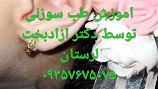 طب سوزنی ازادبخت لرستان