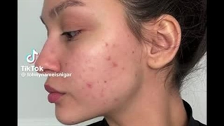 سرم نیاسینامید اوردینری