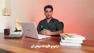 برای درمان اگزما چی بخوریم