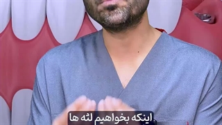 مراحل استفاده از تکنیک پانچ seri 3a