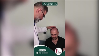 تحلیل وضعیت رشد موی زیباجو بعد از کاشت توسط دکتر خراسانی