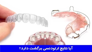 آیا نتایج ارتودنسی برگشت دارد ؟