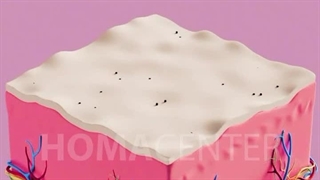 وقتش رسیده که با روش‌ های قدیمی خداحافظی کنید؛ لیزر خانگی هماسنتر در انتظار شماست!