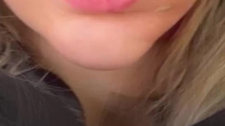 بهترین مرکز تزریق لب در فردیس