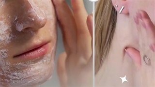 before and afterTretiva 40mg Capsule-