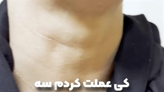 نگران اسکار جراحی دیسک گردن از جلوی گردنی؟!!