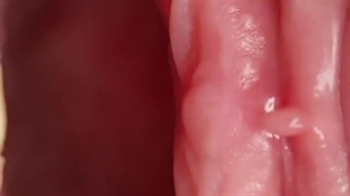 دکتر متخصص ایمپلنت