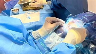 دکتر عباسعلی نوذری چشم پزشک ساری تزریق ژل