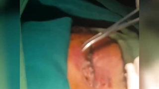 دکتر رضا جعفری بهترین متخصص چشم پزشکی