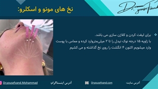 نخ های مونو و اسکلرو