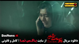 پوست شیر سریال - ژیلا شاهی دندان پیش