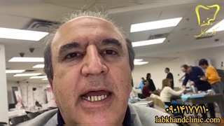 سایش دندانی: مشکلی رایج اما قابل درمان