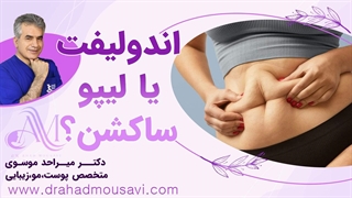 لیزر اندولیفت شکم یا عمل جراحی لیپوساکشن