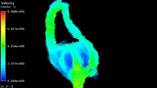 آموزش شبیه سازی ضربان قلب با نرم افزار انسیس فلوئنت