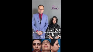 رضایت زیباجو از عمل زیبایی بینی