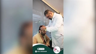 کاشت مو برای موهای نازک | رشد سریع تر با فناوری G-Cell