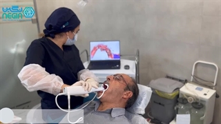 اسکن دیجیتال برای ساخت روکش دندان - دکتر نگین اثنی عشری