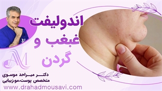 میدونی اندولیفت غبغب چیه؟